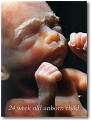 votre enfant